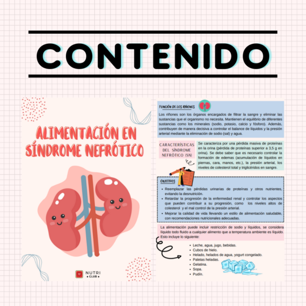 alimentación en síndrome nefrótico